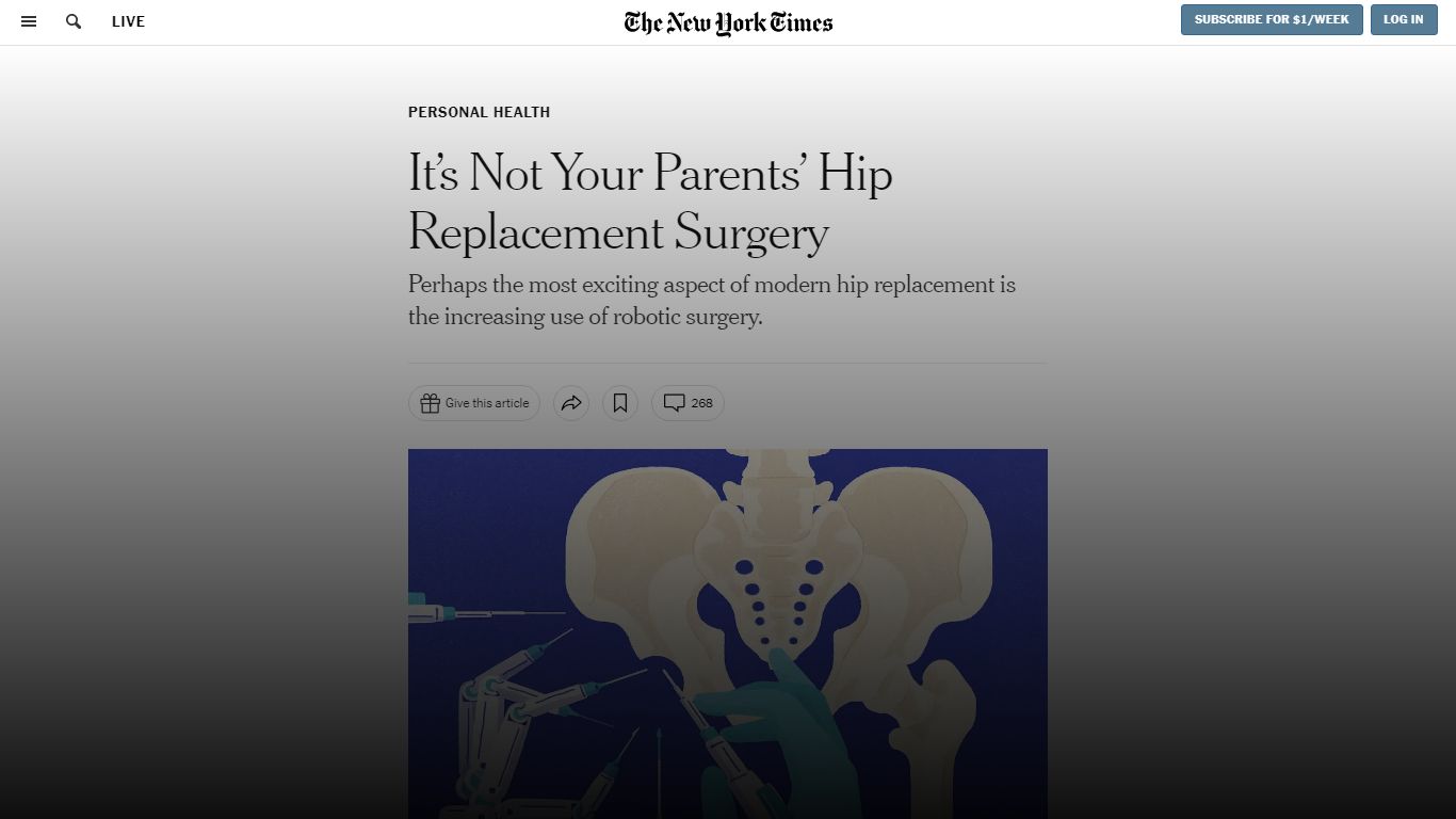 It’s Not Your Parents’ Hip Replacement Surgery