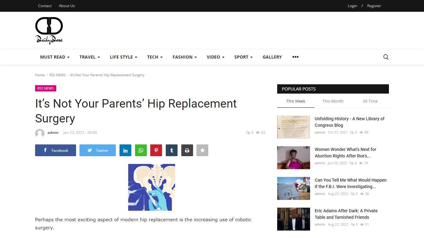 It’s Not Your Parents’ Hip Replacement Surgery